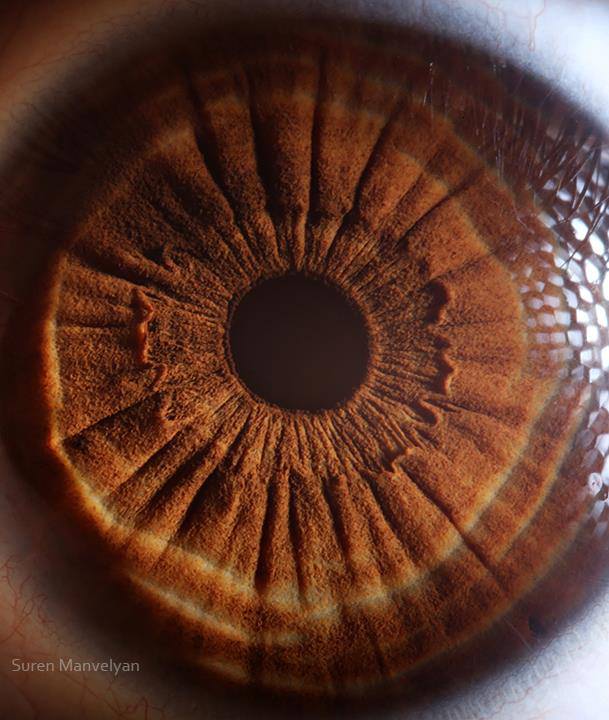 Gözlere bir de yakından bakın - 2