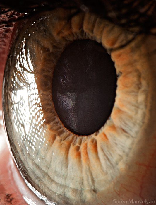 Gözlere bir de yakından bakın - 6