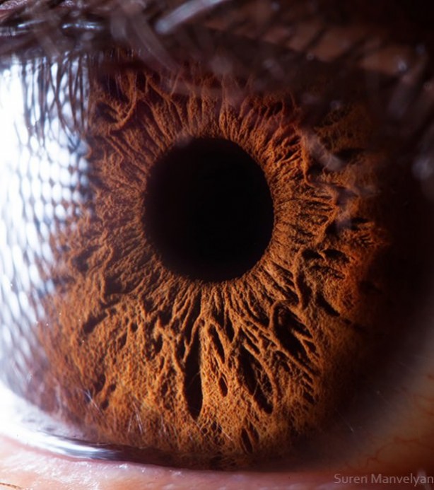 Gözlere bir de yakından bakın - 18