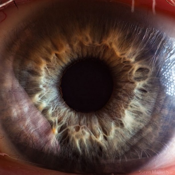 Gözlere bir de yakından bakın - 62