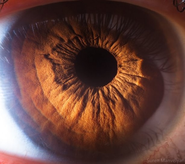 Gözlere bir de yakından bakın - 65