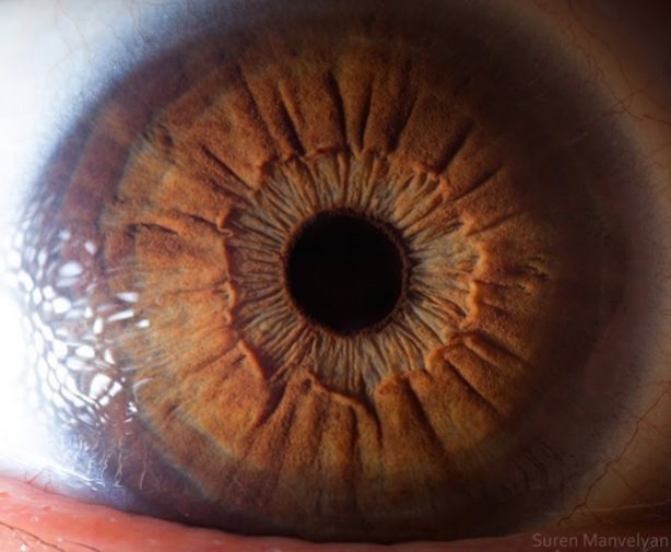 Gözlere bir de yakından bakın - 67