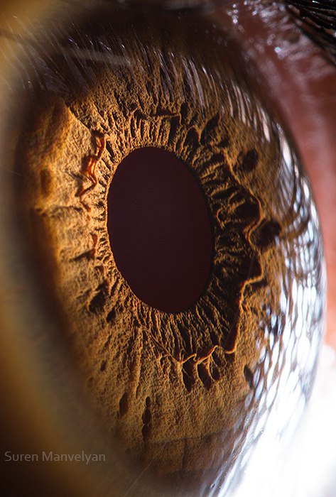 Gözlere bir de yakından bakın - 69