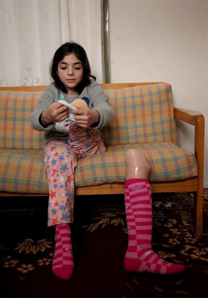 DEAŞ saldırısıyla sakat kalan kardeşler Türkiye'de hayata tutundu - 2