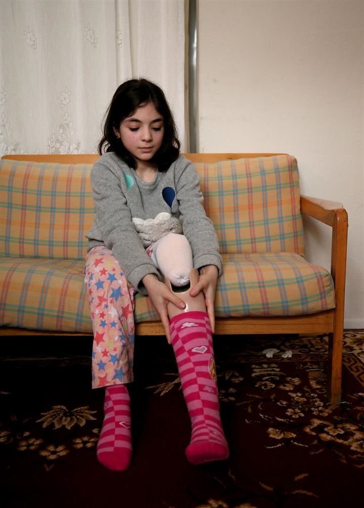 DEAŞ saldırısıyla sakat kalan kardeşler Türkiye'de hayata tutundu - 3