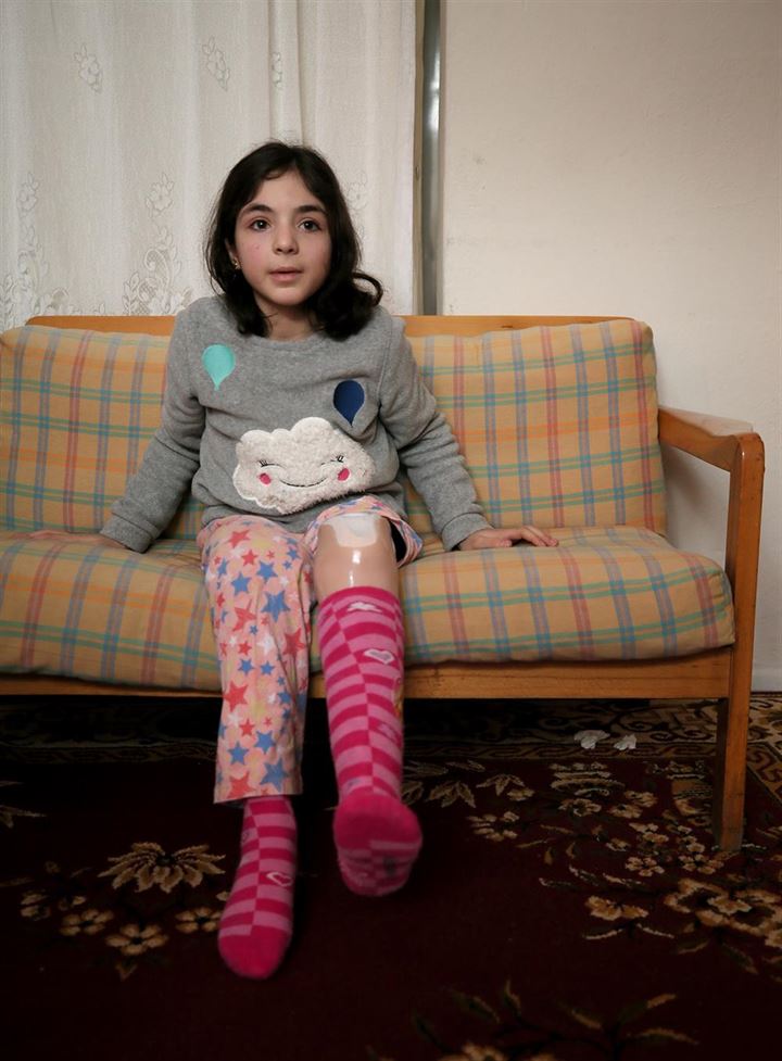 DEAŞ saldırısıyla sakat kalan kardeşler Türkiye'de hayata tutundu - 5