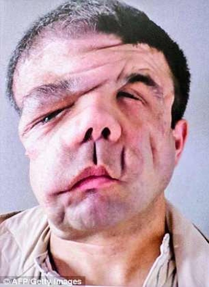 Üç yüzü olan adam - 6