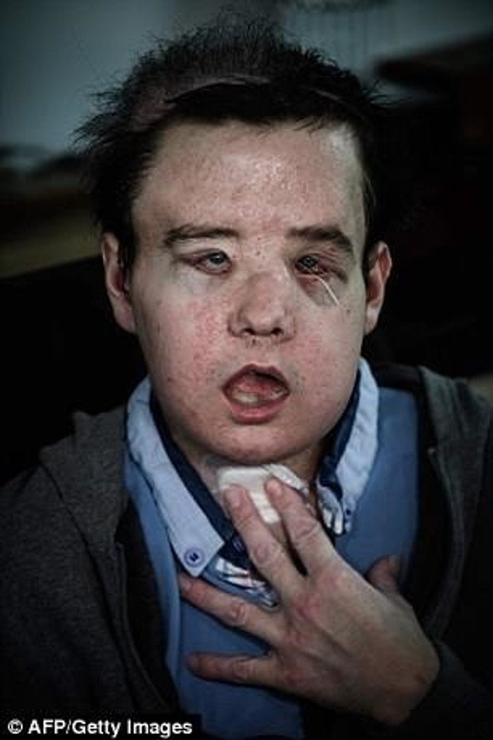 Üç yüzü olan adam - 7