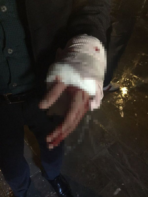 Diyarbakır'daki çatışma anından kareler - 3