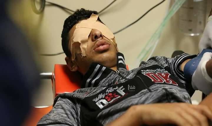 Yaralı 3 Filistinli Ürdün'de - 0