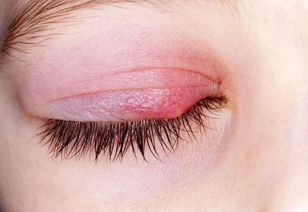 Antibiyotiğin bilmediğimiz yan etkileri - 1