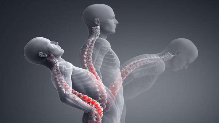 Cüzdanı arka cepte taşımak bel ağrısına neden oluyor - 11