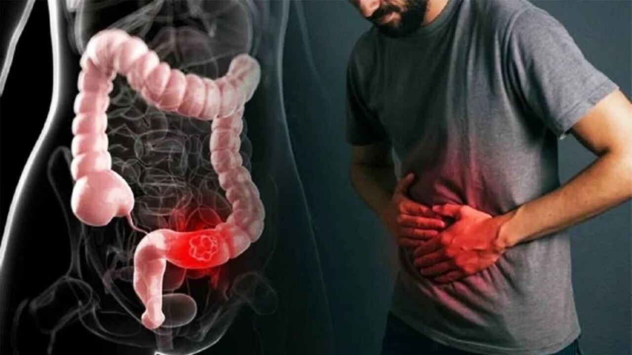 Bayramda sindirim sistemini bozan 5 büyük hata