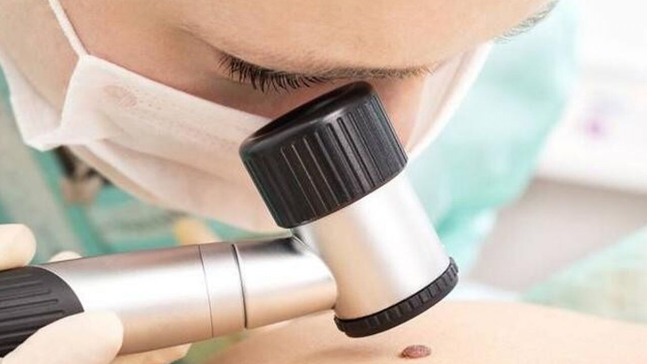 Derideki 'masum' benlere dikkat