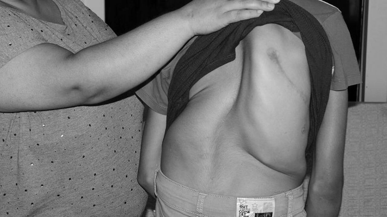 Erken tedavi uyarısı: 'Omurga vücudun pırlantasıdır'