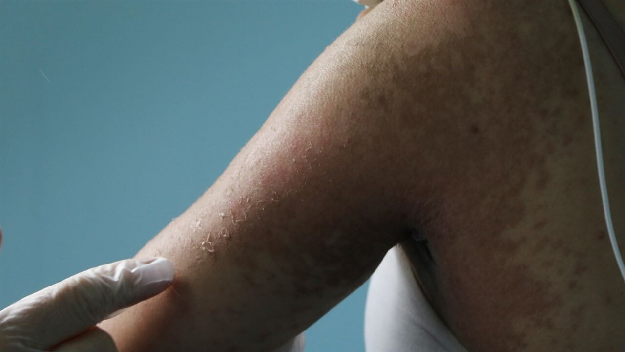 İnternetten sipariş verdiği krem komalık etti