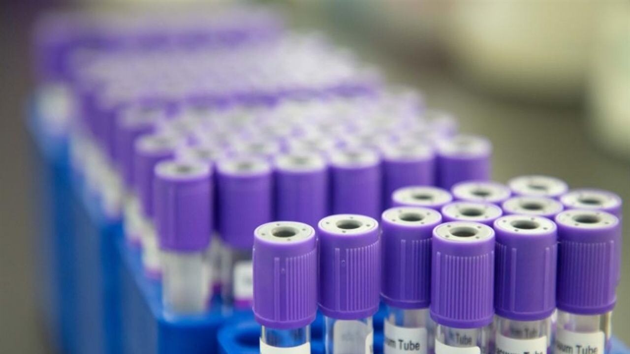 Kanseri tespit edebilen kan testi hazır