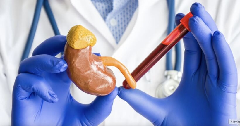 Kreatinin nedir ve neden ölçülür? Kreatinin yüksekliği ve düşüklüğü nedenleri