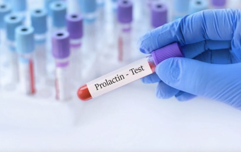 Prolaktin nedir, vücutta ne işe yarar? Prolaktin düşüklüğü ve yüksekliği nasıl anlaşılır, nedenlerdir?