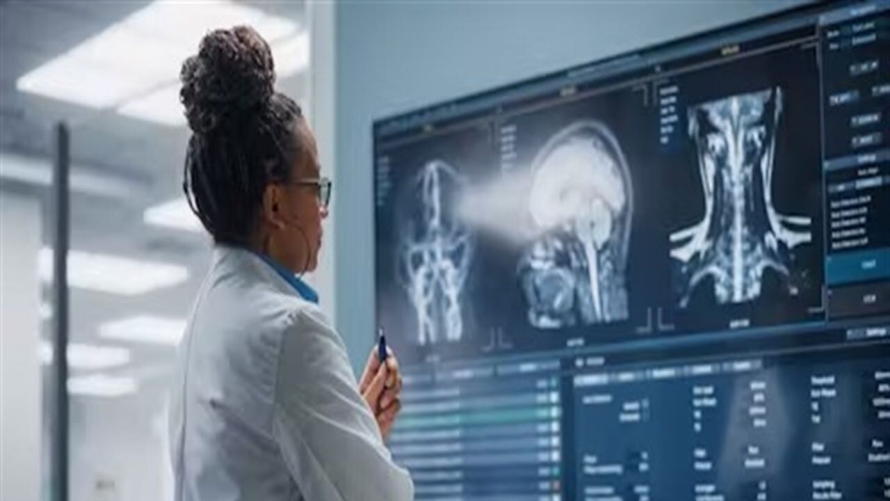 Şizofreni hastalarının beyinlerinde hızlı yaşlanma tespit edildi