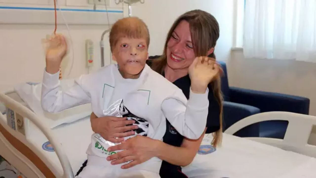Milyonda bir görülen sendrom, 15 ameliyatla kontrol altına alındı