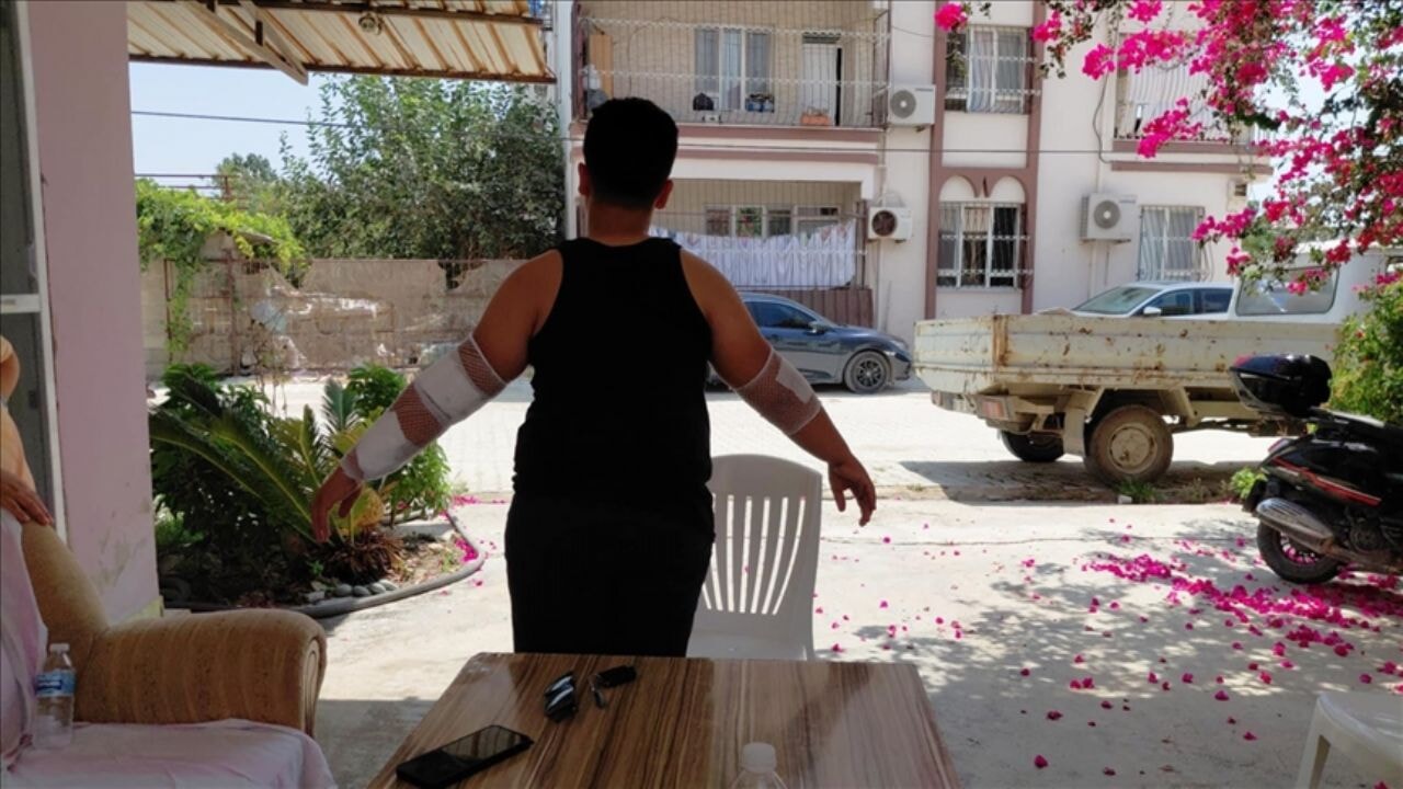 O kentte sahipsiz köpeğin saldırısına uğrayan 10 yaşındaki çocuk yaralandı